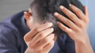 Man running fingers through hair with one hand and holding a clump of hair in the other